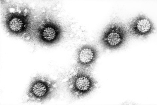 Virus del papiloma humano
